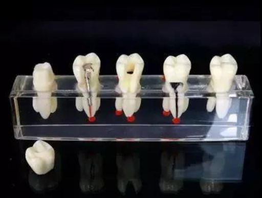 矫正牙齿为什么做分离_牙分离矫正方法
